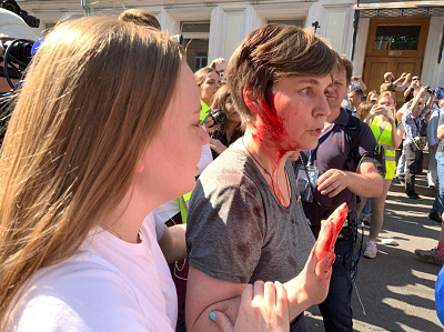 кровь разгон митинга 3 августа в Москве